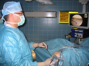 Операция артроскопия - лечение коленного сустава