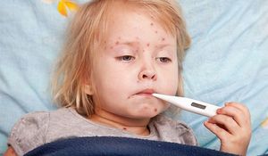 Почему появляется аллергия у детей