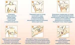 Способы лечения мастопатии