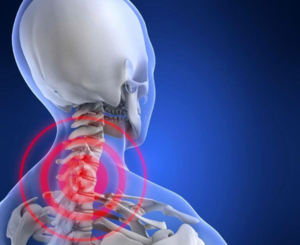 Причинами болей в шее могут быть: остеохондроз,спазмы мышц, переохлаждение