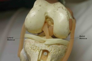 Мениск коленного сустава - анатомия человека