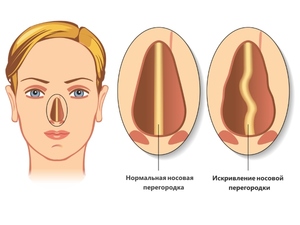 Камера искривления лица