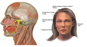 Описание патологии невралгии лицевого нерва