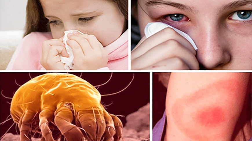 Аллергия на клещей и способы борьбы с ней