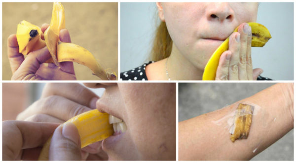 Банановая кожура от синяков: как использовать средство от синяков 2