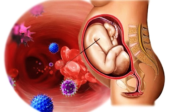 ЦМВ может передаваться ребенку в утробе матери 2