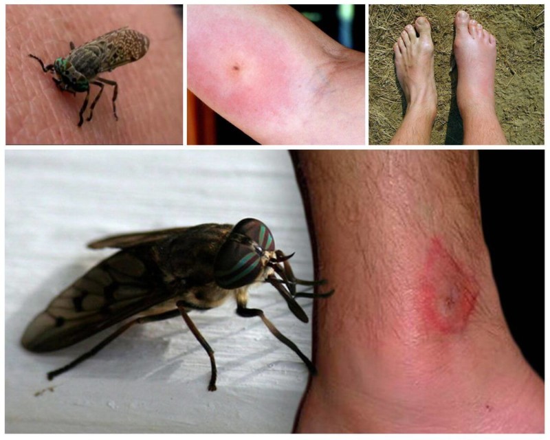 Народные средства от кожной аллергии у взрослых: избавляемся от зуда и прыщей