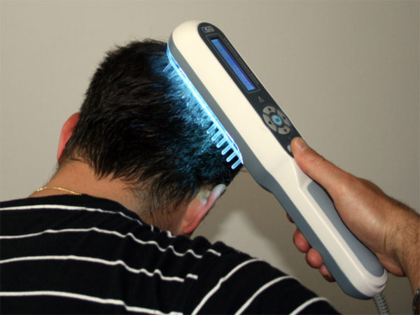 Какое средство от облысения по мужскому типу помогает от выпадения волос и облысения3