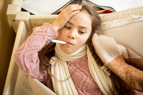 Диарея при ветрянке у детей: когда возникает диарея