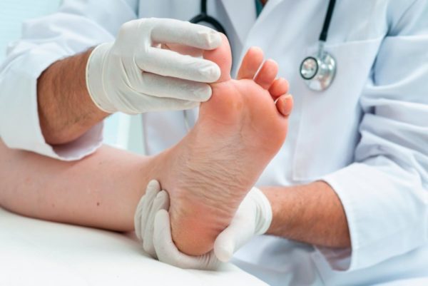 Бородавка на пальце ноги: как она выглядит и какие методы лечения существуют