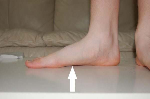 Грибок ногтей на большом пальце ноги: лечение народными средствами и противогрибковыми препаратами2