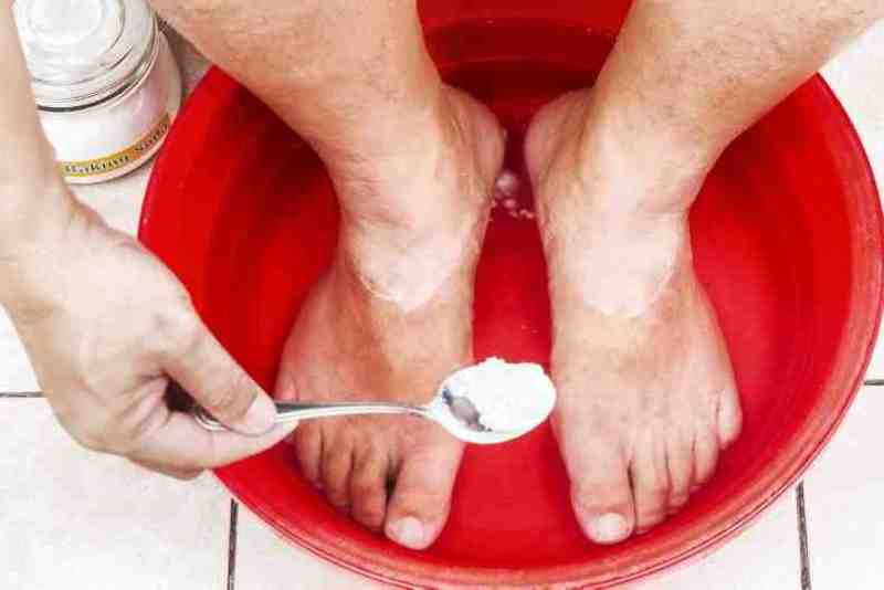 Аммиак при грибке ногтей: рецепты на основе аммиака лечения грибка ног