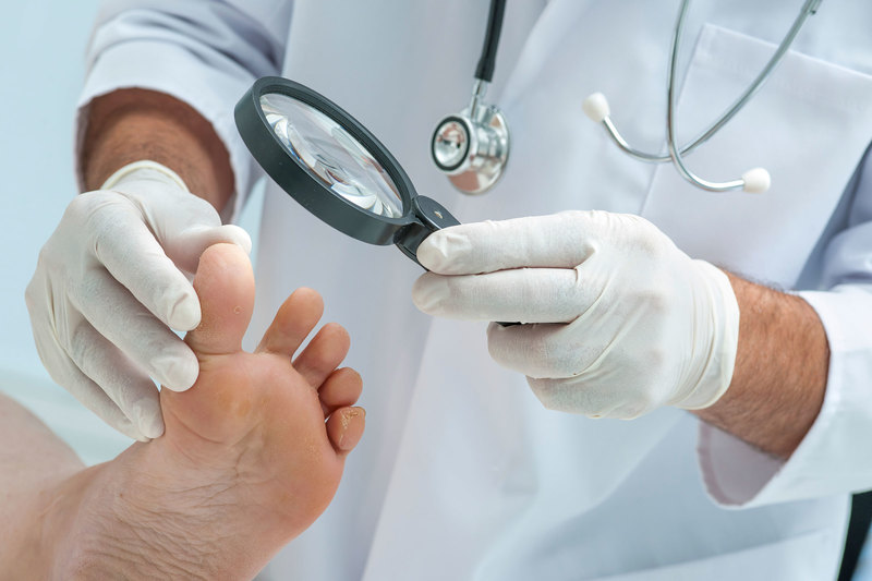 Таблетки от грибка ногтей - список самых эффективных препаратов, как избавиться от микоза на ногах