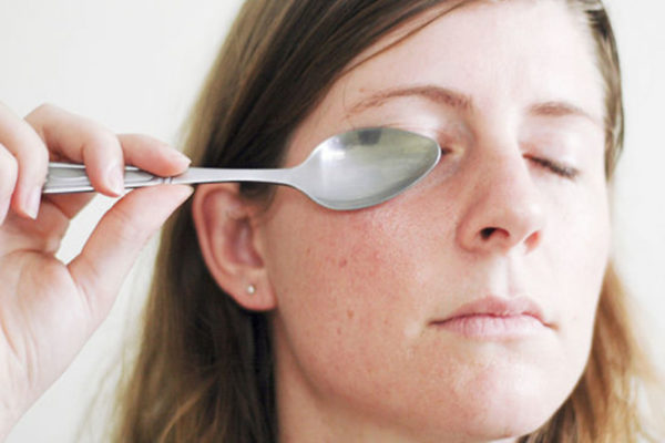 Как убрать синяки под глазами: эффективные способы уменьшить отечность и синяки