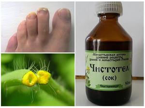 Чистотел от грибка ногтей на ногах: описание и свойства, лечение масляными и фармацевтическими препаратами, отзывы
