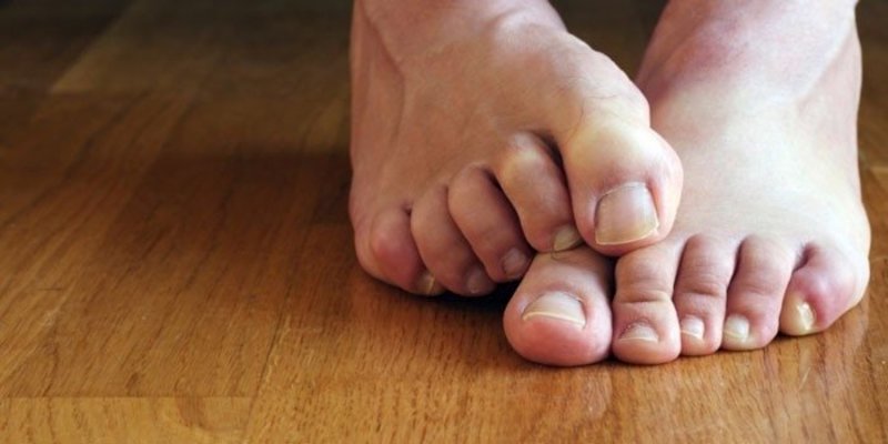 Симптомы грибка ногтей на ногах: первые признаки, особенности проявления различных форм болезни