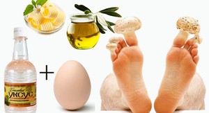 Лечение грибка ногтей яблочным уксусом: народные методы, рецепты с йодом и яйцами, отзывы